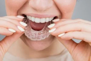 Daily habits that can improve your smile over time