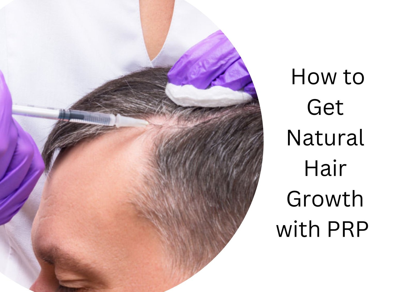 How to Get Natural Hair Growth with PRP